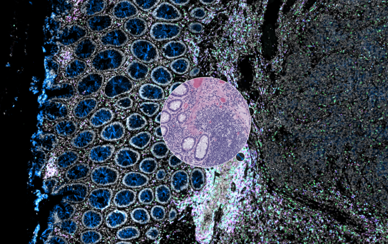 Nueva herramienta para diagnóstico y estudo de cáncer