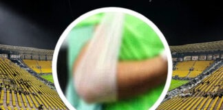 Ronaldo sufre grave lesión que lo deja varios meses fuera