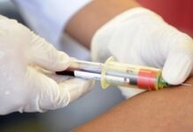 Curan a paciente con VIH tras trasplante