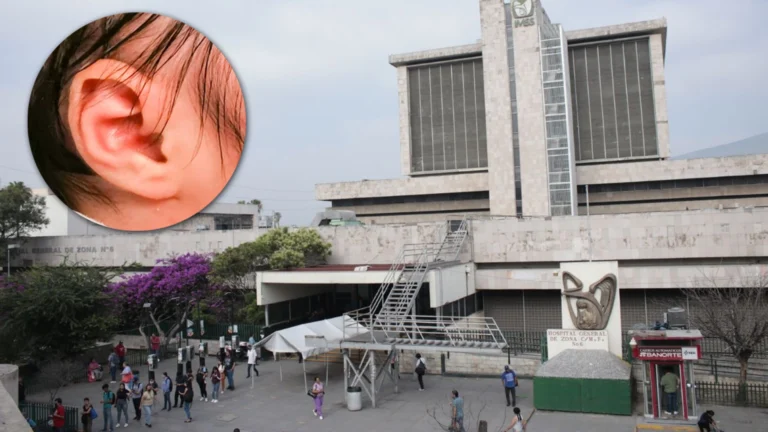 Niño fallece tras picadura de insecto