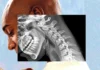 Tecnología provoca impactante “cuerpo de teléfono”, alertan expertos Tecnología provoca impactante "cuerpo de teléfono", alertan expertos