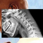 Tecnología provoca impactante "cuerpo de teléfono", alertan expertos