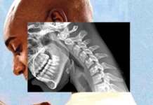 Tecnología provoca impactante "cuerpo de teléfono", alertan expertos