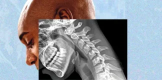 Tecnología provoca impactante “cuerpo de teléfono”, alertan expertos Tecnología provoca impactante "cuerpo de teléfono", alertan expertos