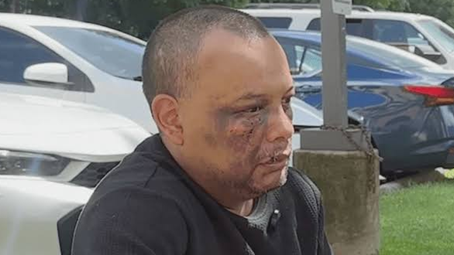Lesiones de José en investigación