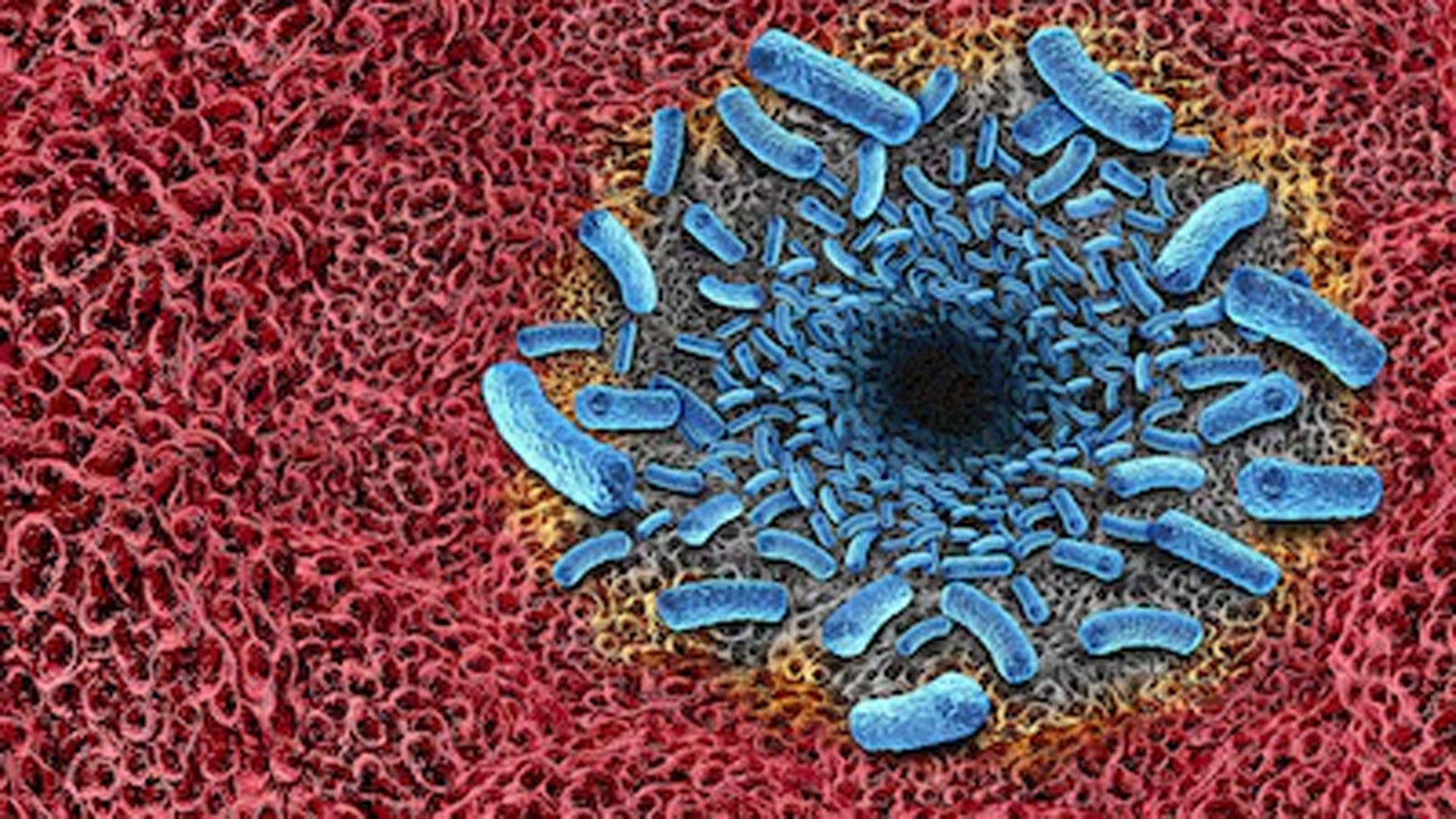 Vibrio vulnificus es vigilado por autoridades sanitarias