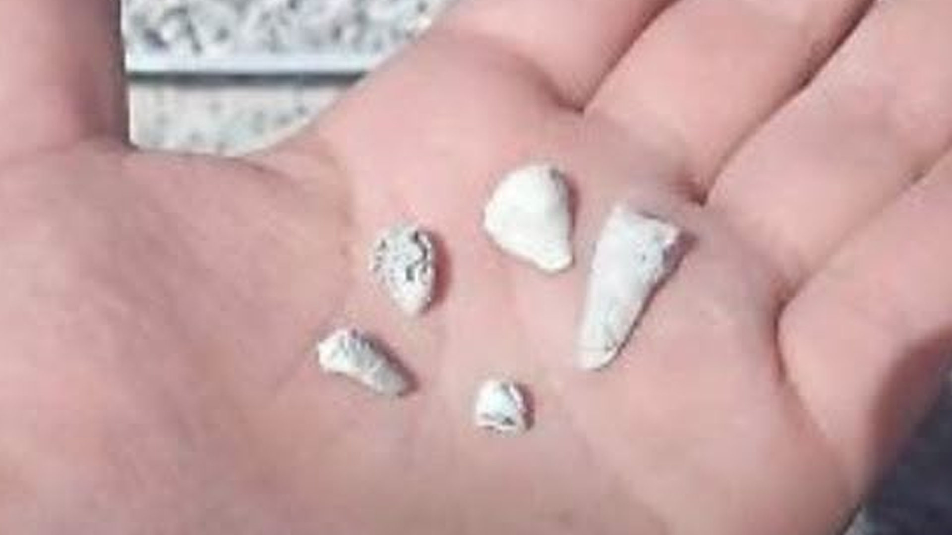Zacapu concentra la atención por hallazgo de piezas dentales